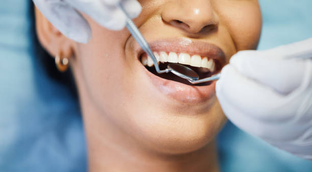 Best Dental Abscess Treatment in Minturn, CO